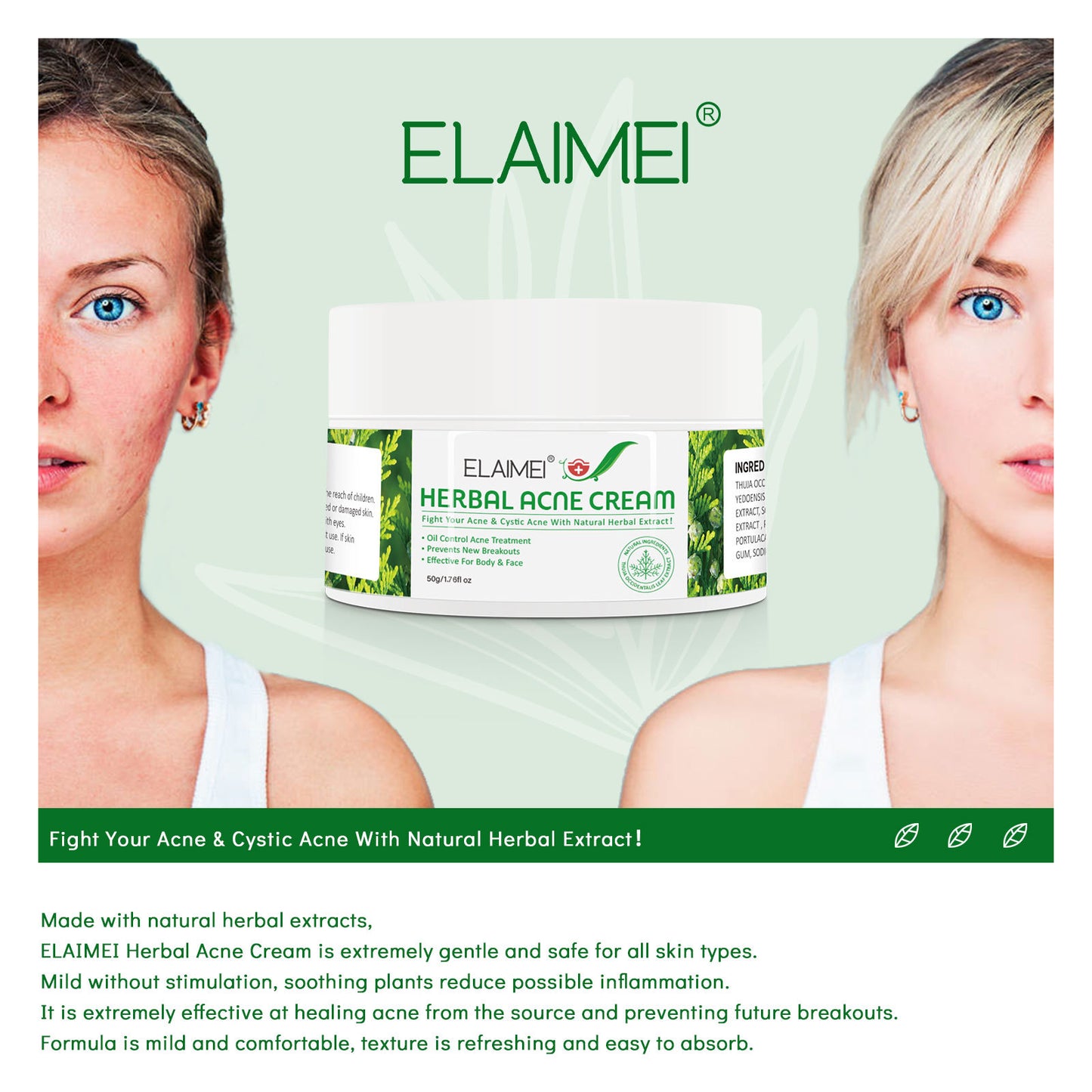 Organic Herbal Extract Anti Acne Treatment Face Cream I Remove Pimple Moisturizing Whitening Skin Care