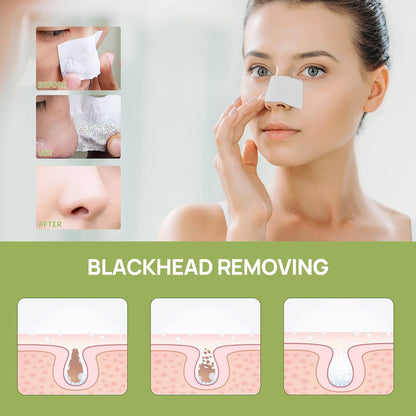LANBENA Lamberna Blackhead Nose  Nose Patch with 60 Blackhead paper Acne Peel Cleansing  Russia